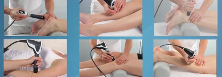 Extracorporeal Shock Wave Therapy - Baltimore, MD: Union Podiatry