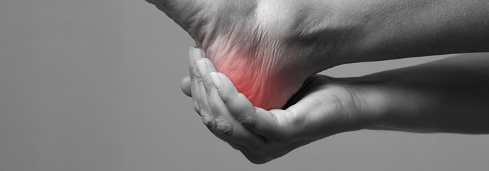 Foot with heel highligthed in red sinalizing pain.