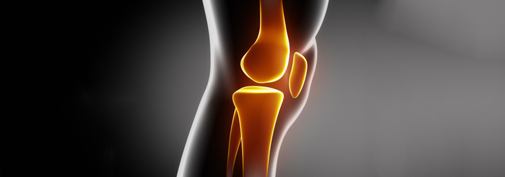Illustration of a knee joint X-ray.